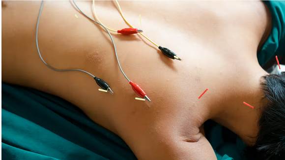 A person with electrodes attached to their chest

Description automatically generated
