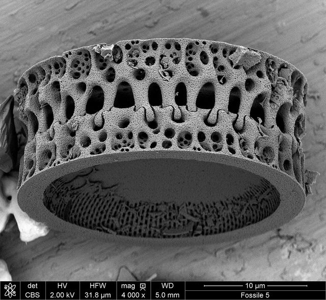 The liliputien king ring - Diatom photo courtesy of Fabrice GASLAIN