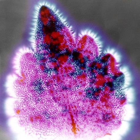 http://aetherforce.com/wp-content/uploads/2014/05/Kirlian_Photograph_of_a_Coleus_Leaf_1980.jpg