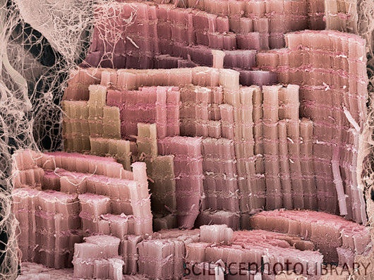 Muscle fibre, SEM