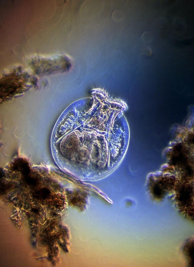 2001: Fresh water rotifer feeding among debris (200x), Darkfield. / Harold TaylorKensworth, UK.